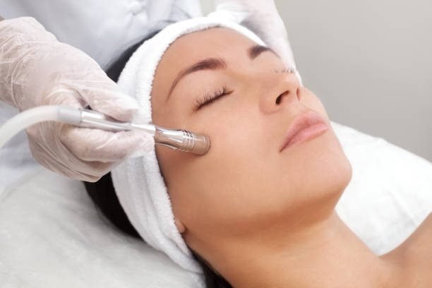 skin polishing treatment in Borivali - Midas Aesthetics