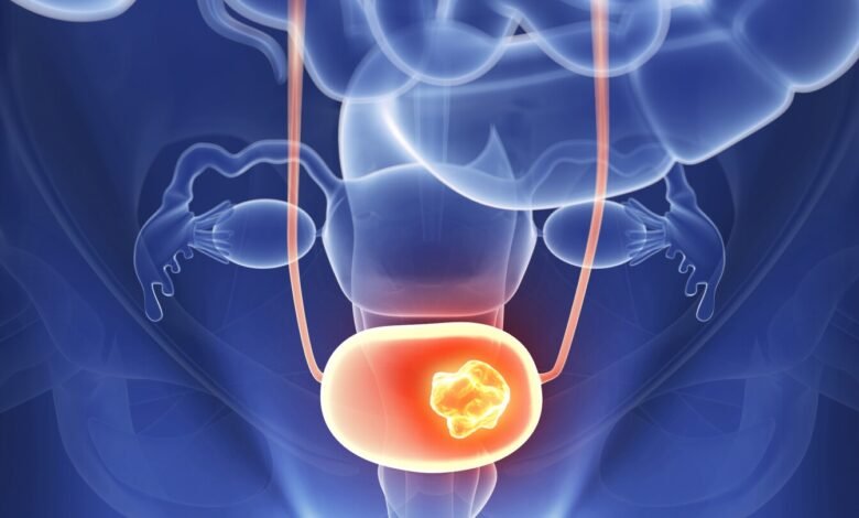 Investigational Therapies For Bladder Cancer: Hope On the Horizon