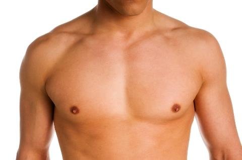 male breast reduction surgery in dubai