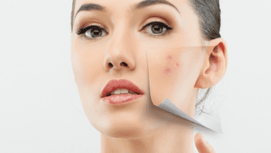 skin lightening treatment ahmedabad